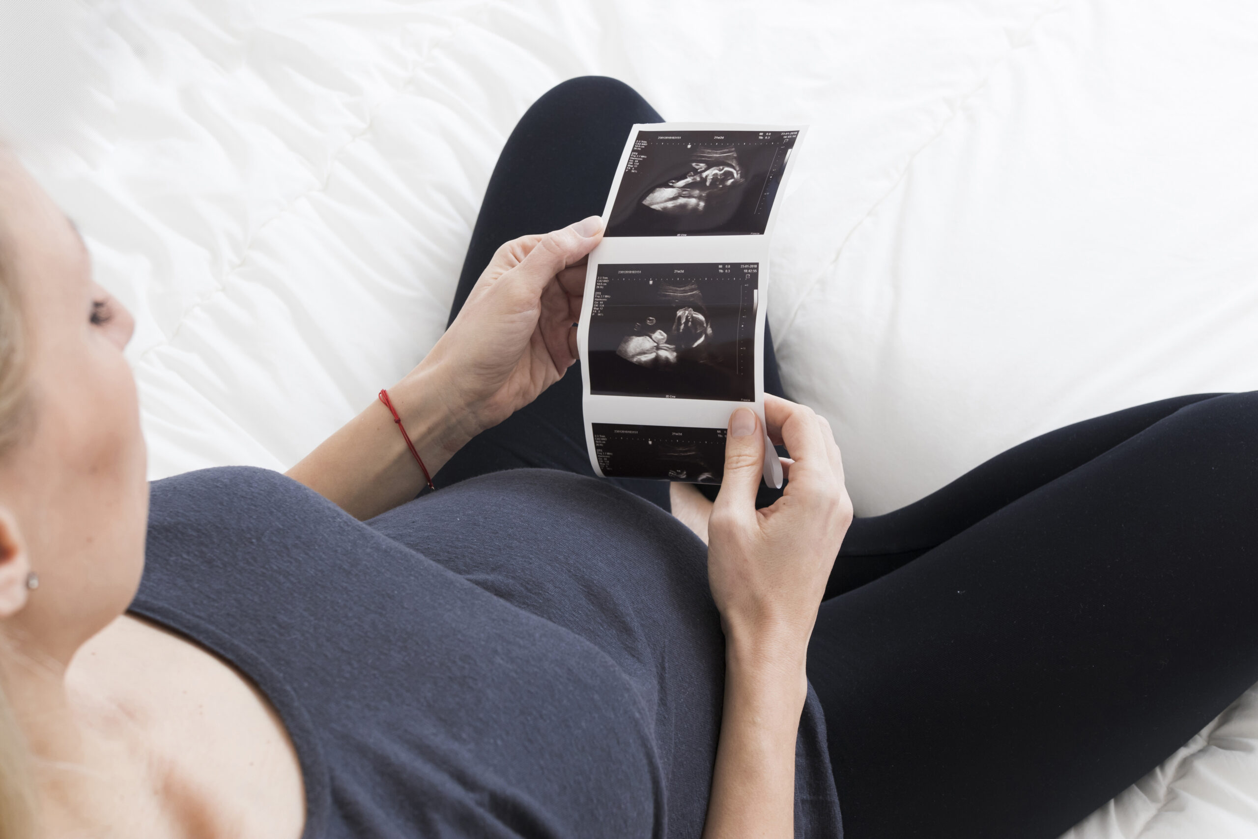 pregnant-woman-looking-x-ray